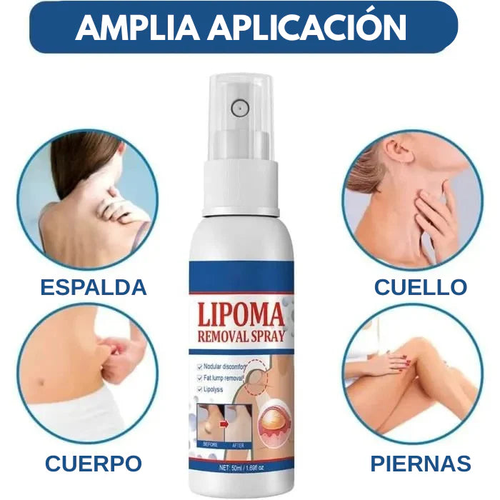 LIPOQUICK™ Spray de Cuidado Avanzado para los Lipomas ¡3x1!