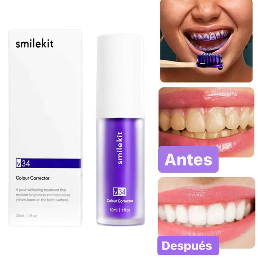Sonrisa Pro V34™ Luce una sonrisa más blanca al instante