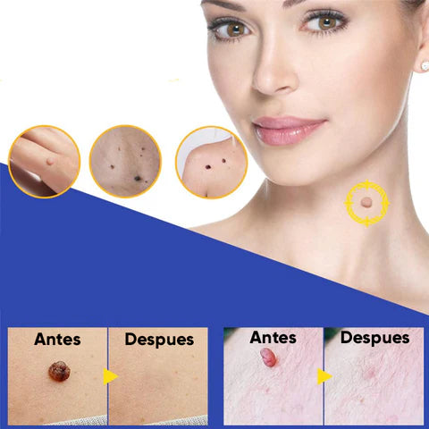 FormuClear Parches Anti Verrugas ¡108 parches!